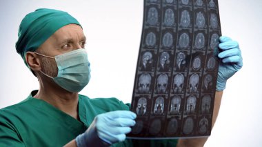 Physician examining brain scan, checking recovery progress, medical treatment clipart