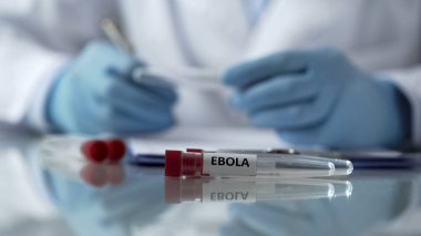 Ebola virüs mutasyon etkilerini açıklayan hastalık kontrol merkezi işçisi