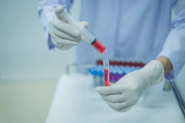 Tıbbi teknisyen laboratuarda test için tüplere kan örneği bırakıyor..