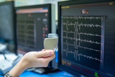 Doktor El, Ekg izleme arka planına sahip Pacemaker aygıtını tut
