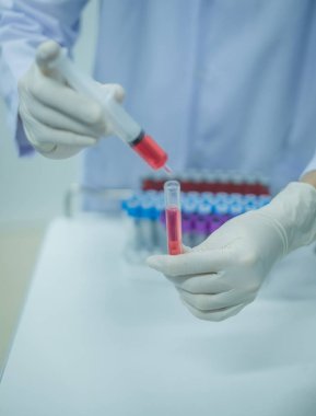 Biyolog tüpün içine sıvı kan bırakıyor, laboratuvarda çalışıyor. Tıbbi teknisyen laboratuarda test için tüplerde kan örneği tutuyor..