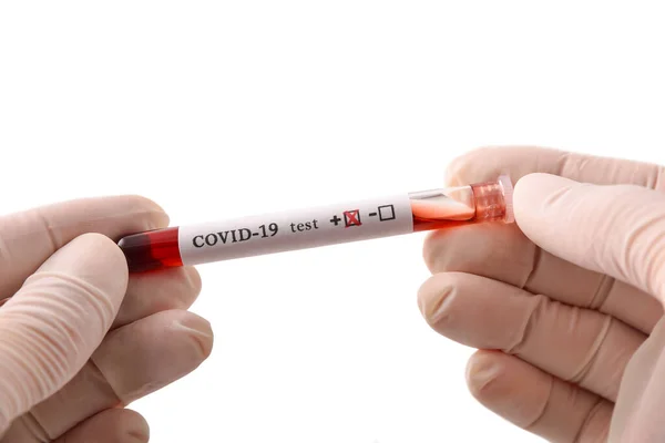 Koruyucu Eldivenli Eller Kovid Virüsü Bulaşmış Kan Örneğiyle Test Tüpü — Stok fotoğraf