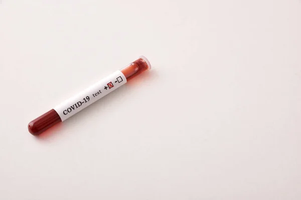 Tubul Testare Probă Sânge Infectată Covid Masa Albă Vedere Înaltă — Fotografie, imagine de stoc