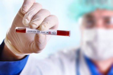 Önlüklü ve koruyucu eldivenli tıbbi personel tüp ve pozitif Coperid 19 test tüpü gösteriyor.