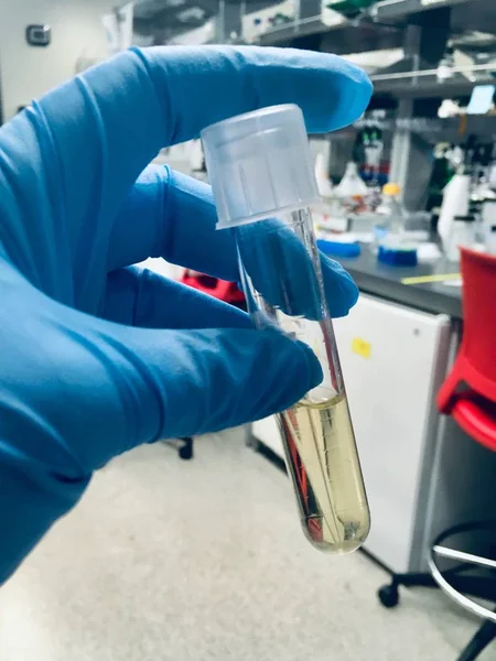 Mezzi di coltura liquidi (LB) in un tubo di laboratorio gestito da un tecnico — Foto Stock