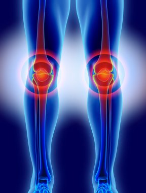 Diz acı - iskelet x-ray.