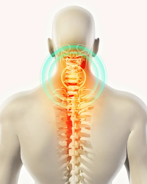 Boyun Ağrılı - cervica omurga iskelet x-ray, 3d çizim. — Stok fotoğraf