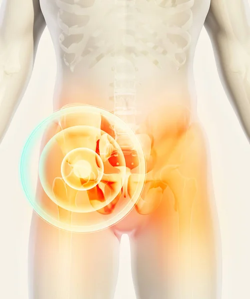 Radiografía del esqueleto doloroso de la cadera, ilustración 3D . — Foto de Stock