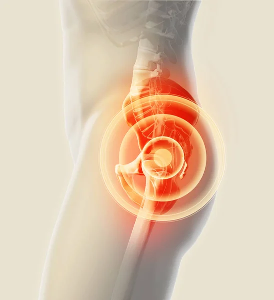 Hip painful skeleton x-ray, 3D illustration. — Stock Photo, Image