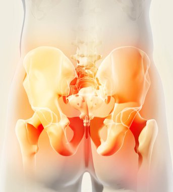 Kalça acı iskelet x-ray, 3d çizim.