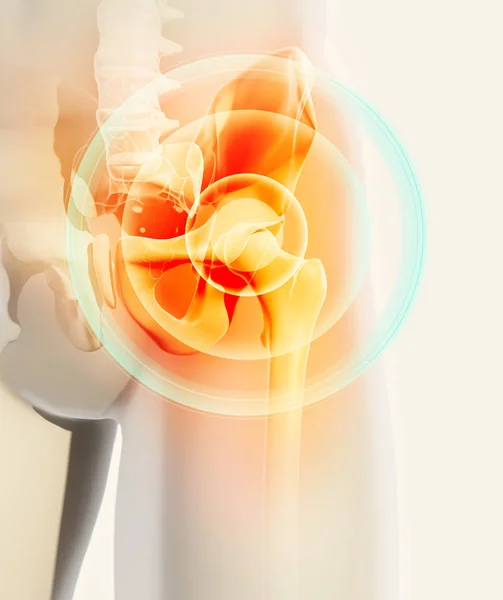 股関節痛みを伴うスケルトン x 線、3 d イラストレーション. — ストック写真