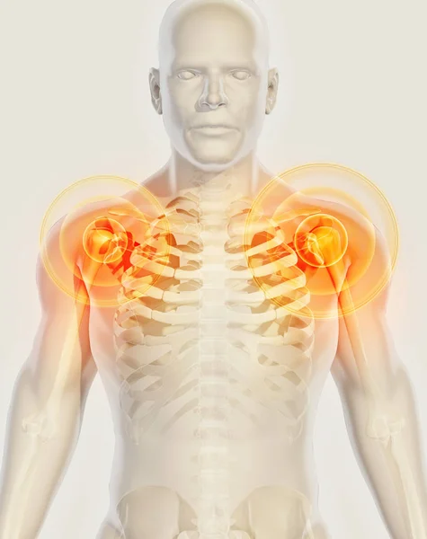 Rayos X del esqueleto doloroso del hombro, ilustración 3D . —  Fotos de Stock