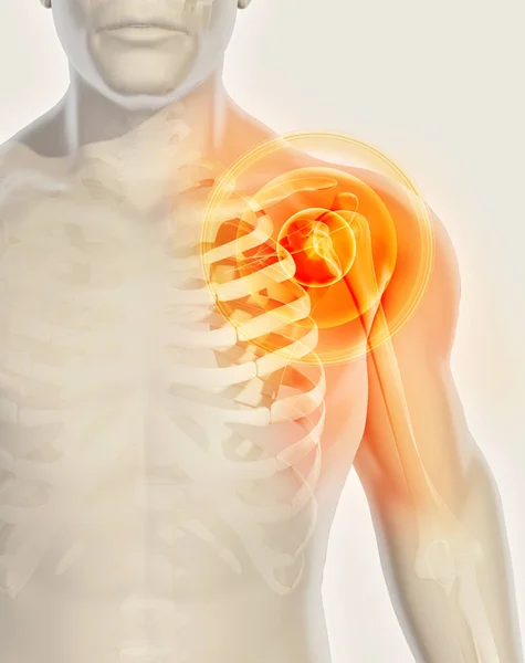 Schulter schmerzhaftes Skelett Röntgen, 3D-Illustration. — Stockfoto
