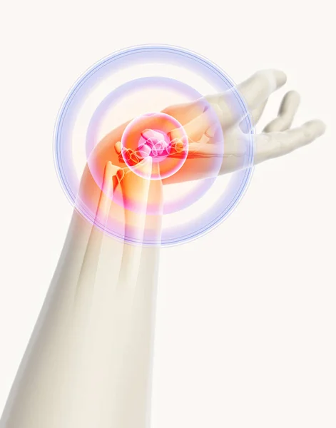 Handgelenk schmerzhaft - Skelett röntgen. — Stockfoto