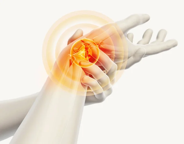 腕关节痛苦-骨骼 x 射线. — 图库照片