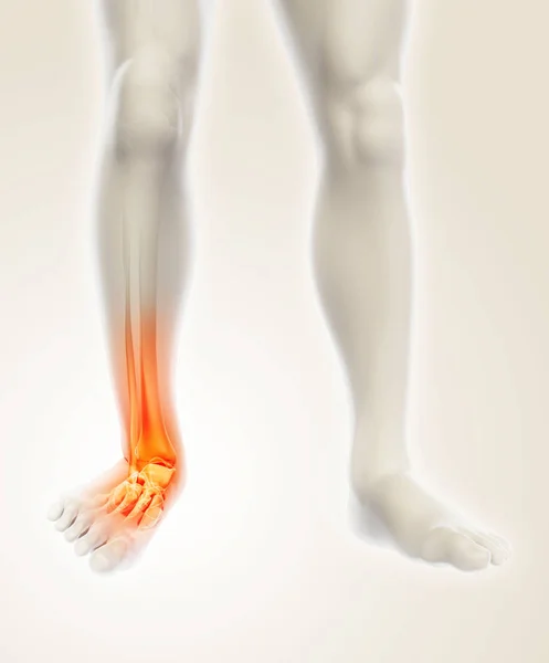 Ayak bileği acı - iskelet x-ray. — Stok fotoğraf