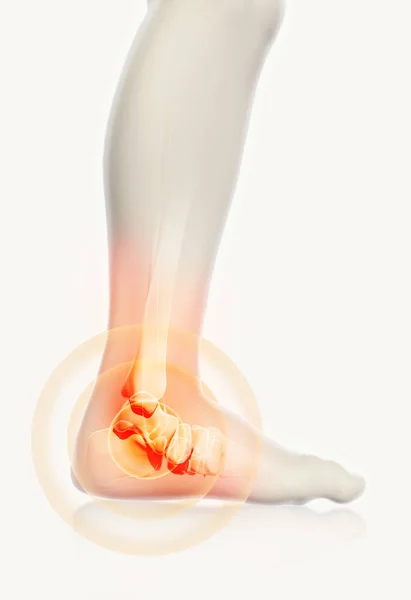 足首痛み - スケルトン x 線. — ストック写真