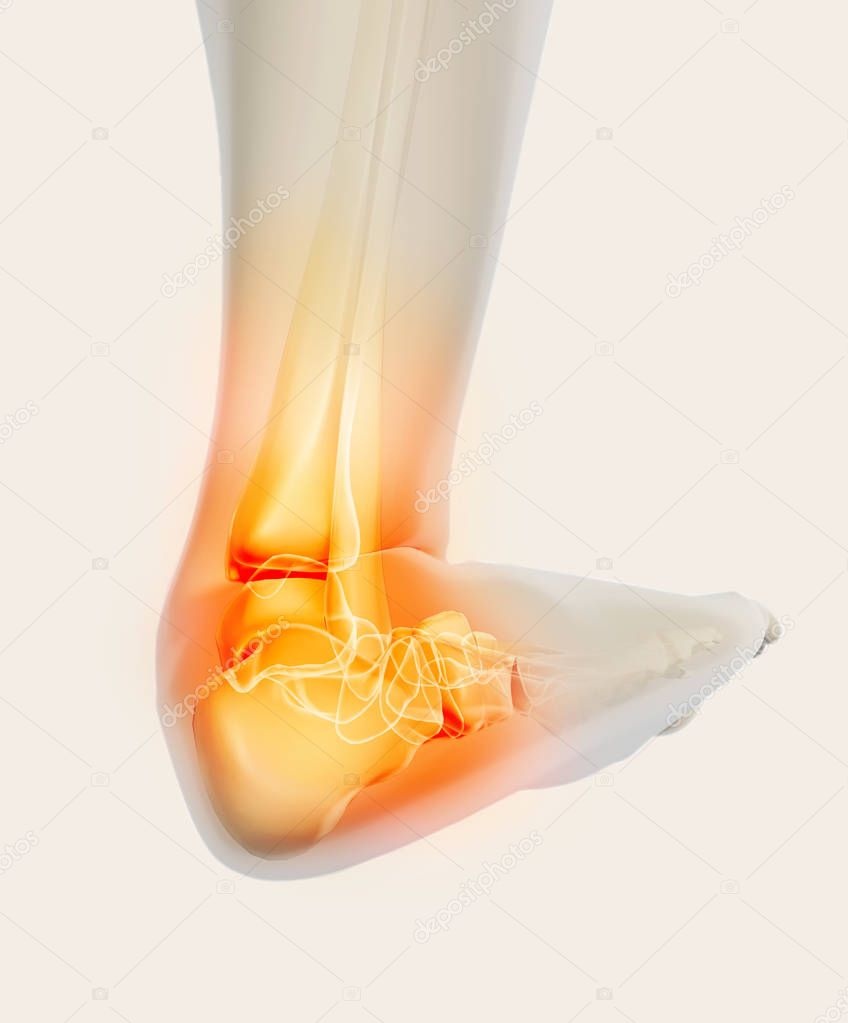 Ankle painful - skeleton x-ray.