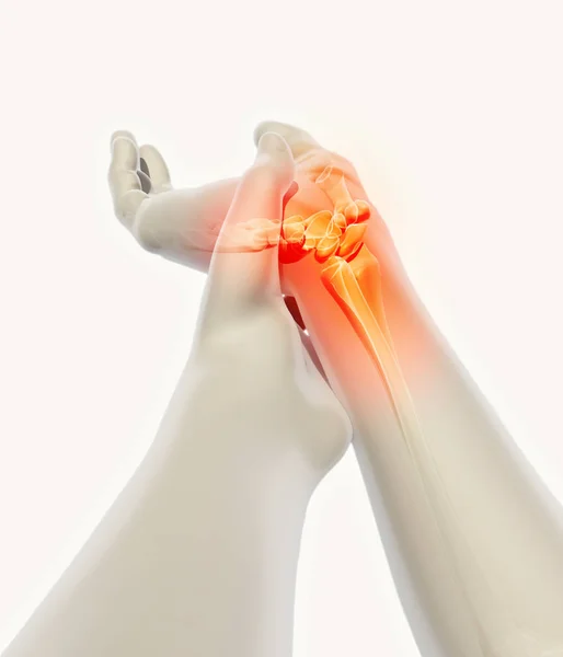 Zápěstí bolestivé - kostry x-ray. — Stock fotografie