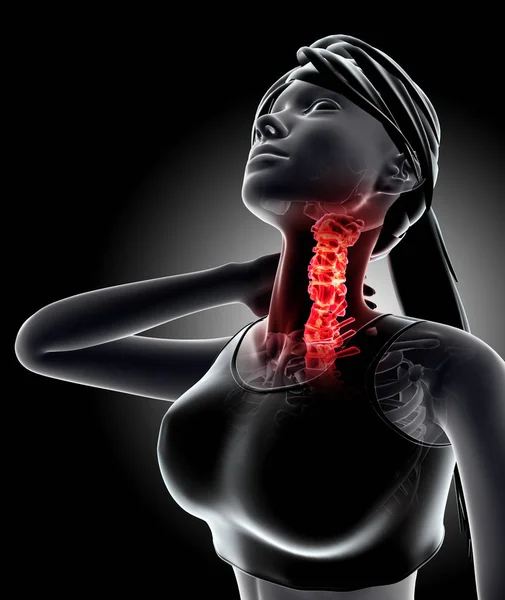 Cou douloureux - squelette de la colonne cervicale radiographie, illustration 3D . — Photo