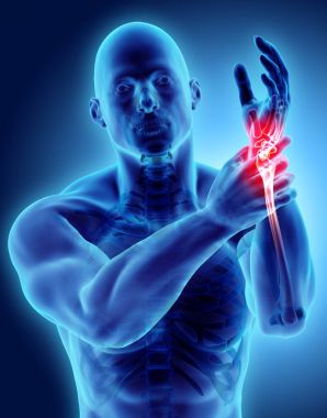 Bilek acı - iskelet x-ray.