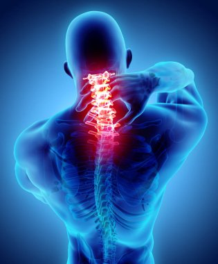 Neck painful - cervical spine skeleton x-ray, 3D illustration. clipart