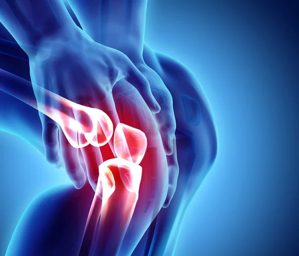 Knee painful - skeleton x-ray. — Stock Photo, Image
