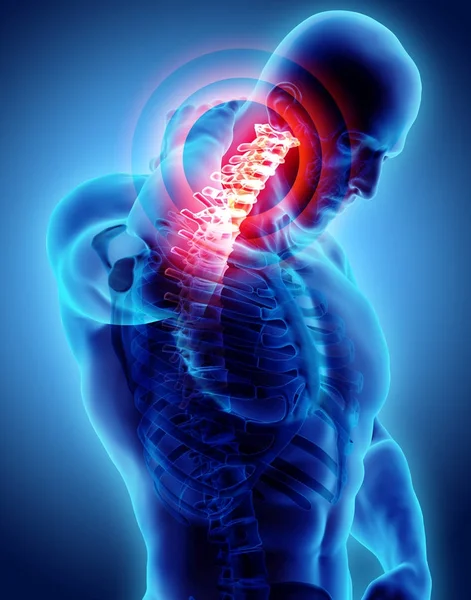 Cuello doloroso: radiografía del esqueleto de la columna cervical, ilustración 3D . — Foto de Stock