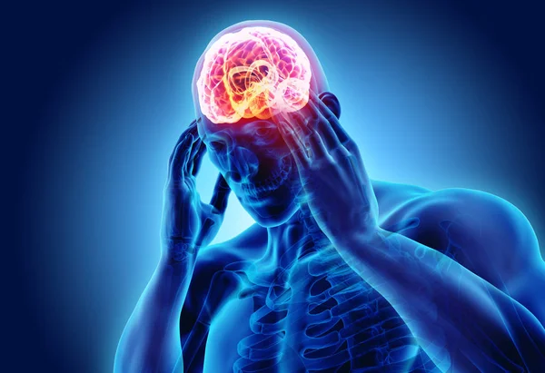 Ilustración 3d de dolor de cabeza humano . — Foto de Stock