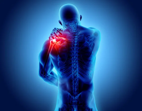 Rayos X del esqueleto doloroso del hombro, ilustración 3D . —  Fotos de Stock
