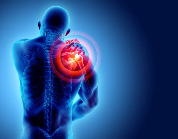 Omuz acı iskelet x-ray, 3d çizim.