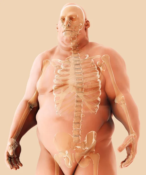 3d Illustration männliche Fettleibigkeit, Gesundheitswesen medizinisches Konzept. — Stockfoto