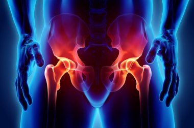 Kalça acı iskelet x-ray, 3d çizim.