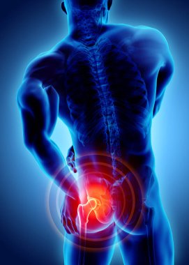Kalça acı iskelet x-ray, 3d çizim.