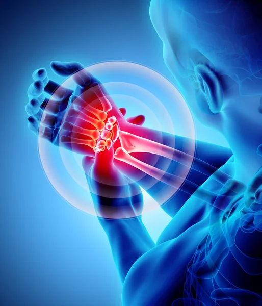 Bilek acı - iskelet x-ray.