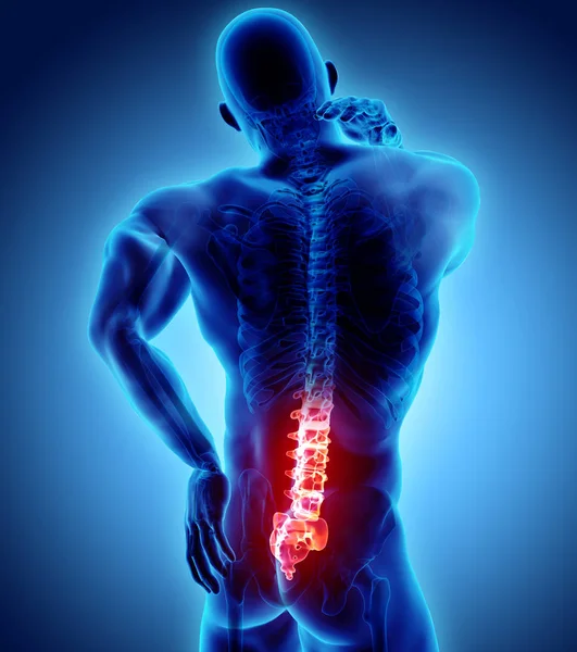 sakral omurga acı 3D çizimi.