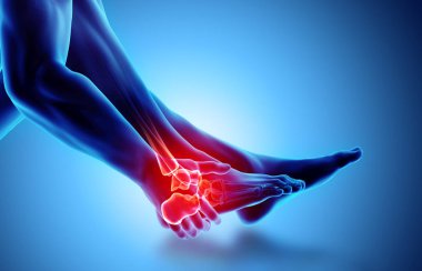 Ayak bileği acı - iskelet x-ray.