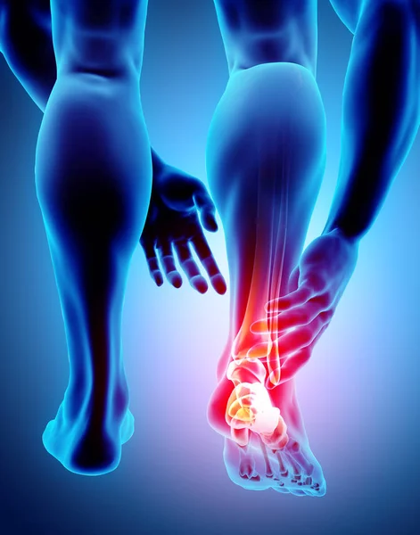 Ayak bileği acı - iskelet x-ray.