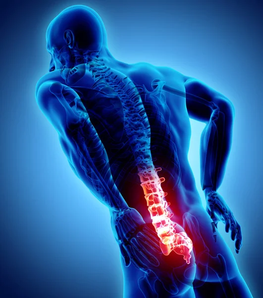 3D Illustration of sacral spine painful. — Stock Photo, Image