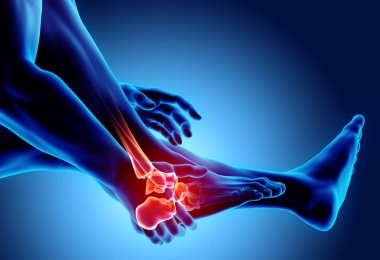 Ayak bileği acı - iskelet x-ray.