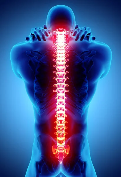 Ilustración 3D del dolor sacro y cervical . — Foto de Stock