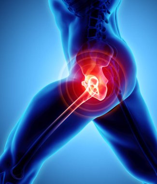 Kalça acı iskelet x-ray, 3d çizim.