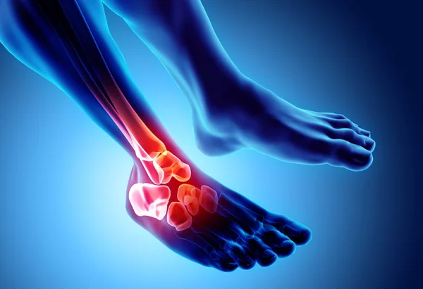 Caviglia dolorosa - radiografia dello scheletro . — Foto Stock