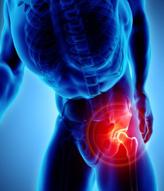 Kalça acı iskelet x-ray, 3d çizim.