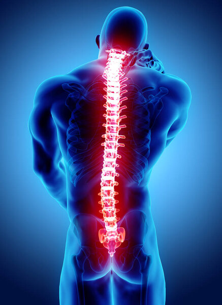 3D Illustration of sacral and cervical painful.