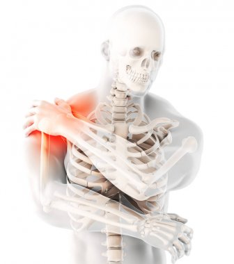 3D çizim, omuz acı iskelet x-ray, tıp kavramı.