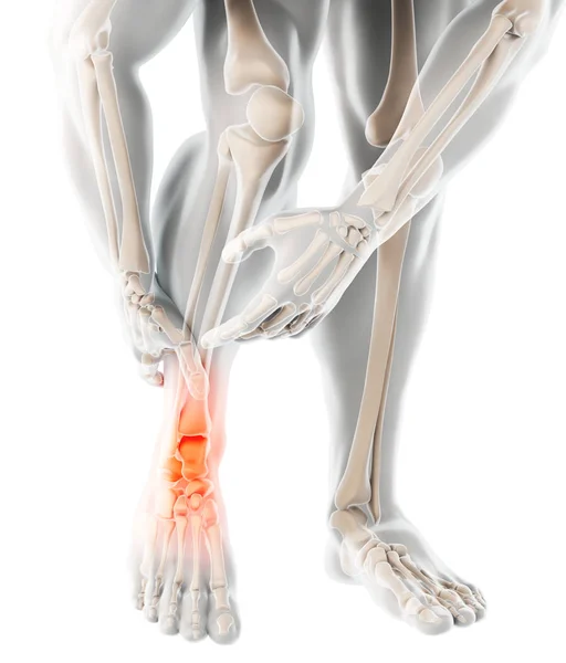 Болючість Щиколотки Рентгенівський Скелет Ілюстрація Медична Концепція — стокове фото