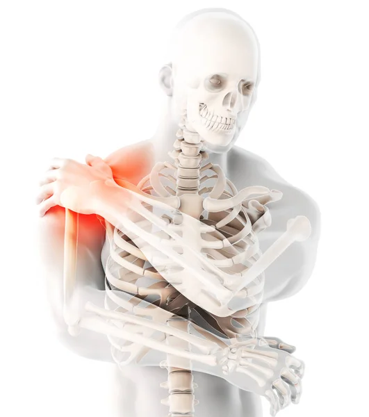 Ilustração Ombro Esqueleto Doloroso Raio Conceito Médico — Fotografia de Stock