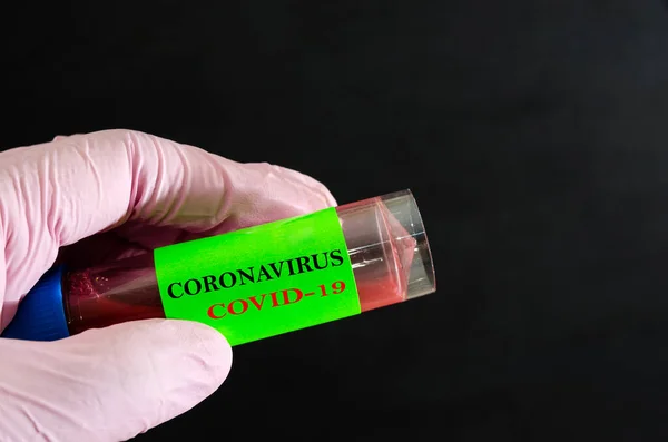 Foto Concettuale Test Coronavirus Una Mano Tiene Una Provetta Mano — Foto Stock