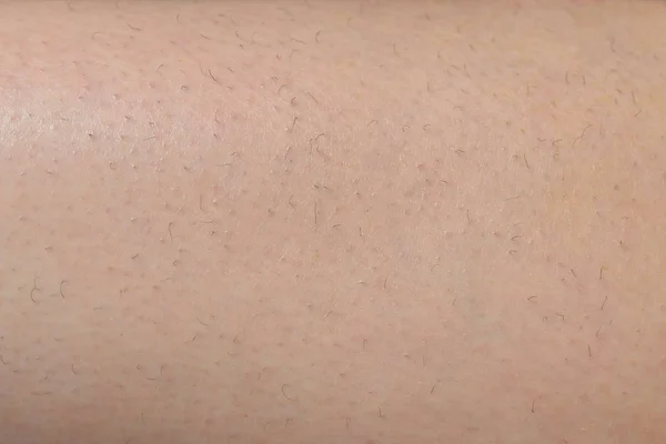Een stukje huid op het been met volwassen haren. Vóór de procedure — Stockfoto